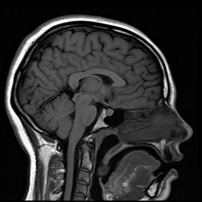 Biological Psychology – Brain Imaging Techniques – MRI